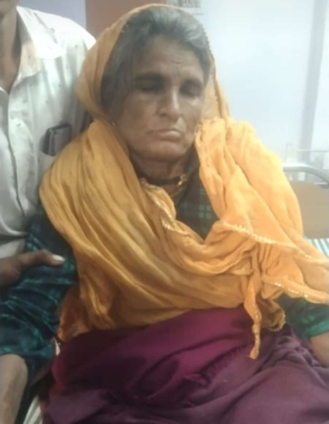 कांटी में यूरिया खाद लेने उमड़ी भीड़ , बेकाबू होने से महिला कि कुल्हे की हड्डी टूटी